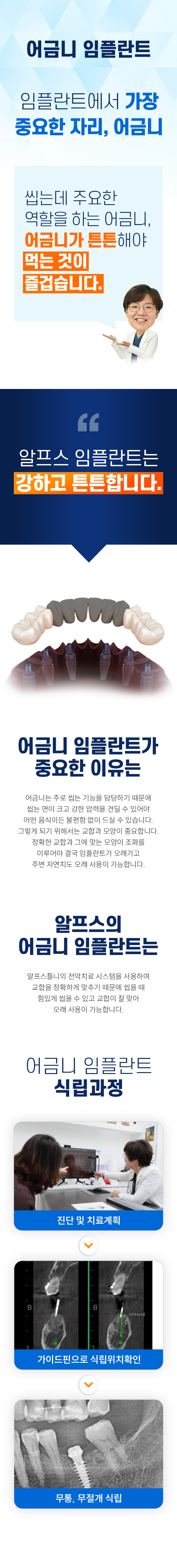 어금니 임플란트
